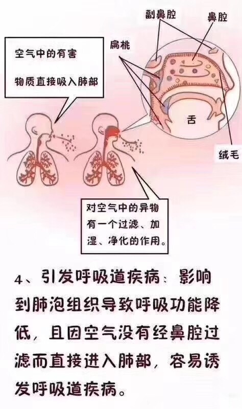 慢画形象的家长普及鼻炎腺样体肥大导致张口呼吸的危害希望更多的家长